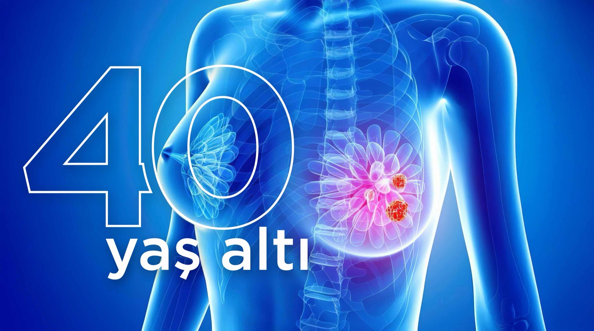40 Yaş Altında Meme Kanseri: Bilinmesi Gereken 15 Önemli Gerçek